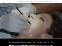 Dental Implant Clinic in Tijuana Dental Art Clinic Affordable Dental I