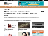 Male pattern baldness: hair loss, dandruff and thinning hair solution