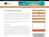 Hair transplant | Best Hair transplant clinic in Bangalore | HTW