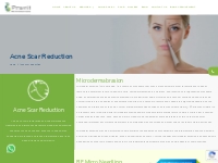  Pimples/Acne Treatment Coimbatore | Pimples Treatment