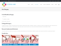 Oral Surgery | S S Dental Care