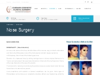 Nose Surgery in Chennai | Rhinoplasty Surgery in Chennai