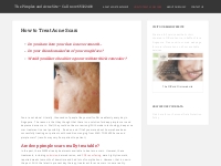 Deep Acne Scar Treatment for Adults - Call us Today
