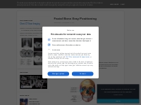 Facial Bone Xray Positioning - RadTechOnDuty