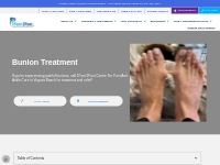 Bunion Treatment and Pain Relief | Suffolk, Hampton, Virginia Beach VA