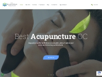 Best Acupuncture Services in Orange County, CA | Dr. Narges