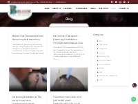 Blogs about Hair Transplant and Hair Care