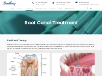 Root Canal Treatment - Bradbury Dental Surgery