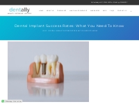 Dental Implant Success Rates: What You Need to Know - Dent Ally