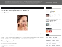 Tips to remove Pimples and Pimples Marks