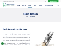 Best Tooth Extraction in Abu Dhabi | Tooth Extraction Abu Dhabi