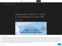 Smiling with Confidence: A Guide to Dental Implants in Chino Hills   H