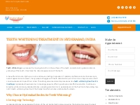 Best Teeth Whitening in Madhapur - Hyderabadsmiles