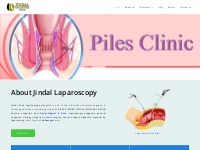 Best Endoscopy   Laparoscopic Surgeon in Kota | Jindallaparoscopy