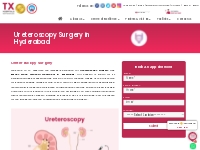 Advanced Ureteroscopy Surgery in Hyderabad | Expert Urology Team