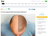 Is Non-Surgical Hair Restoration Effective?