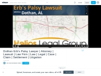 Dothan Erb s Palsy Lawyer | Attorney | Lawsuit | Law Firm  | Law | Leg