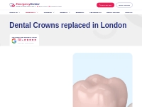 Same-day Dental Crown Replacement - 24H Emergency Dentist