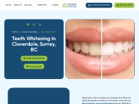 Teeth Whitening in Surrey | 5 Corner Dental
