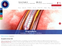 Cardiology Consultations | Angioplasty