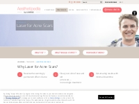 Acne Scars Removal - Acne Scars Laser Treatment | Aesthetipedia.com