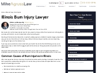 Illinois Burn Injury Attorney | Mike Agruss Law
