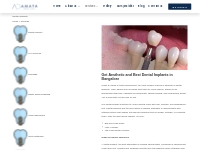Dental Implants Bangalore | Dental Implantologist Bangalore