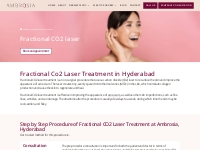 Fractional Co2 Laser Treatment in Hyderabad: Procedure   Side Effects 