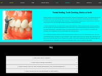 Dental Scaling, Teeth Cleaning, Stains on teeth