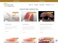 Denture Services - Atlas Dental Toronto