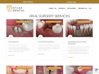 Oral Surgery Services - Atlas Dental Toronto