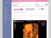 Baby Scanning Aberdeen | Special Offers on Pregnancy Scans