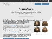 Alopecia Areata Information and Treatments