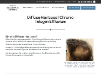  Diffuse Hair Loss – Information and Advice