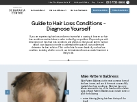 Guide to Hair Loss Conditions – Diagnose Yourself