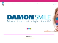 Damon Braces for Straight Teeth | Before and After Photos