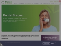 Dental Braces Coventry | Orthodontics Braces | Bhandal Dental Practice