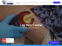 Leg Vein Center | Vein Specialists in Boca Raton, FL