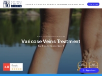 Varicose Veins Treatment in Boca Raton, FL | Boynton Beach, FL