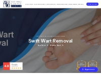 Swift Wart Removal - Foot, Ankle   Leg Vein Center