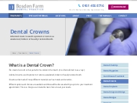 Dental Crowns Stockport | Bosden Farm Dental Practice