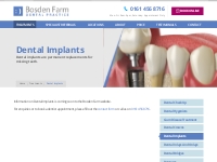 Dental Implants Stockport | Bosden Farm Dental Practice
