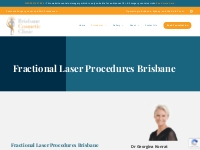 CO2 Laser Resurfacing - Laser Scar Treatment | Brisbane Cosmetic Clini