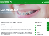 Dental Braces Singapore | Teeth Straightening Invisible Braces