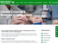 Dental Crowns Singapore | Tooth Crowning Cost | Burlinson