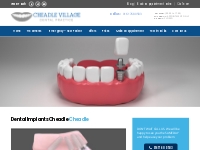 Dental Implants Cheadle | Tooth Replacement | Cheadle Dental