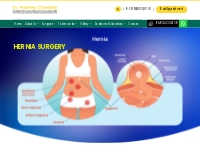      Best Hernia Treatment in Delhi | Laparoscopic Hernia Surgery