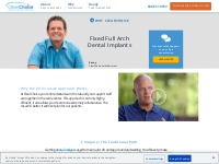 Fixed Full Arch Dental Implants | ClearChoice