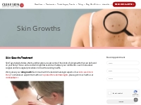 Skin Growth | Skin Growth On Face | Clear Skin