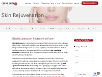 Skin Rejuvenation | Skin Resurfacing Treatment | Clear Skin